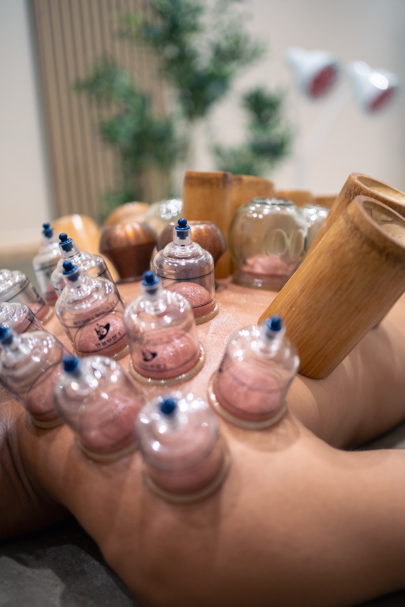 Hijama dos 3 — DAR HIJAMA Brussel